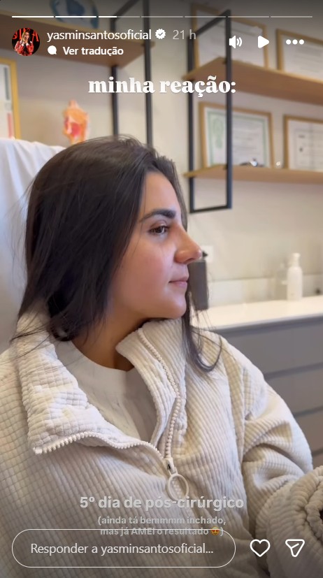 Yasmin Santos mostra resultado da rinoplastia - Reprodução/Instagram @yasminsantosoficial 