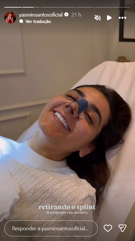 Yasmin Santos mostra resultado da rinoplastia - Reprodução/Instagram @yasminsantosoficial 