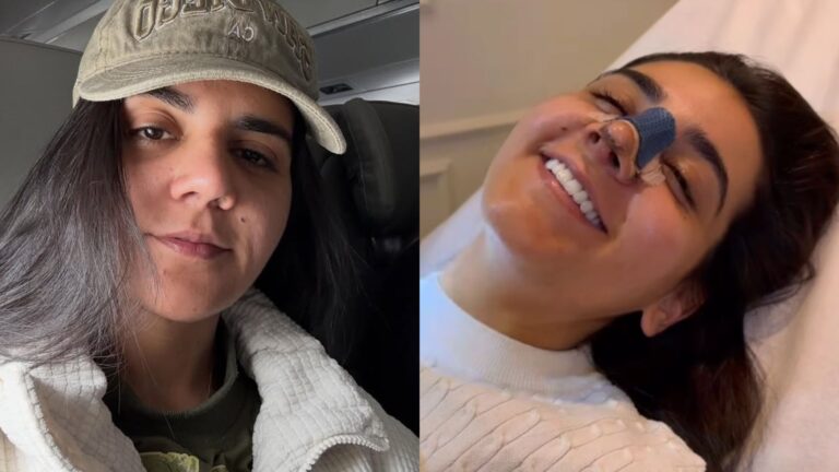 Yasmin Santos se choca com resultado de cirurgia plástica: ‘Outra pessoa’