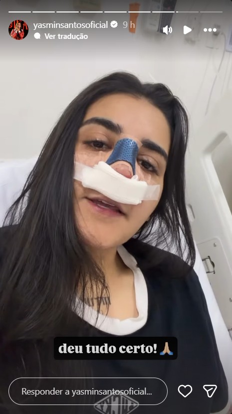 Yasmin Santos passa por rinoplastia - Foto: Reprodução / Instagram @yasminsantosoficial