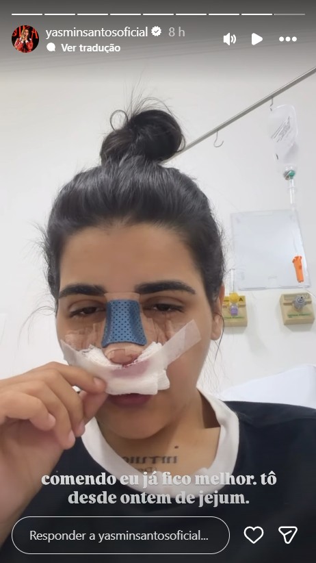 Yasmin Santos passa por rinoplastia - Foto: Reprodução / Instagram @yasminsantosoficial