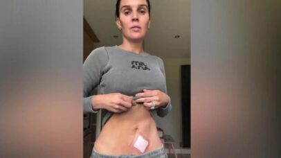Danielle Lloyd após cirurgia para remoção de pinta - Foto: Reprodução/Instagram