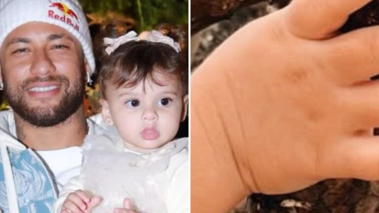 Dedo da filha de Neymar: imagem atualizada surpreende e revela situação real; o que mudou?