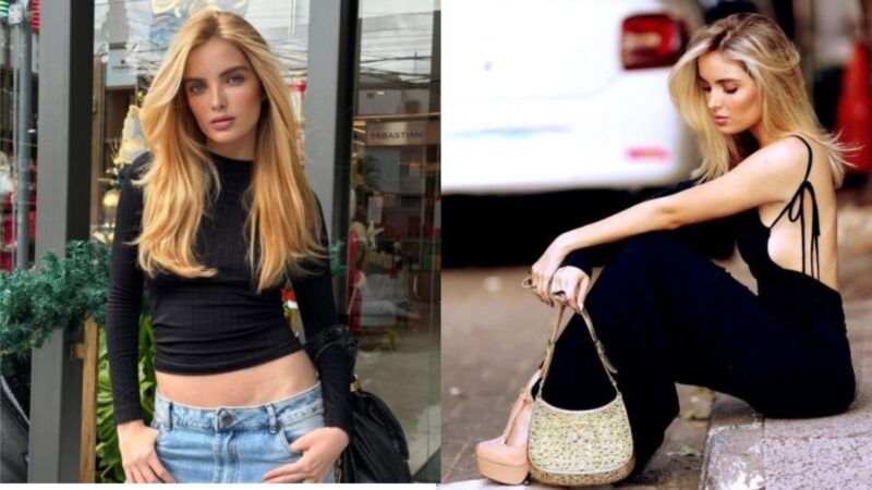 Giovanna Chaves acumula procedimentos estéticos; saiba quais