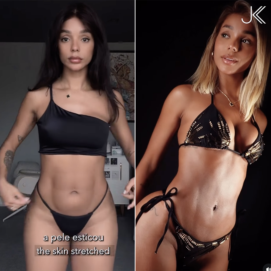 Antes e depois de Brunna Gonçalves - Foto: Reprodução / Instagram