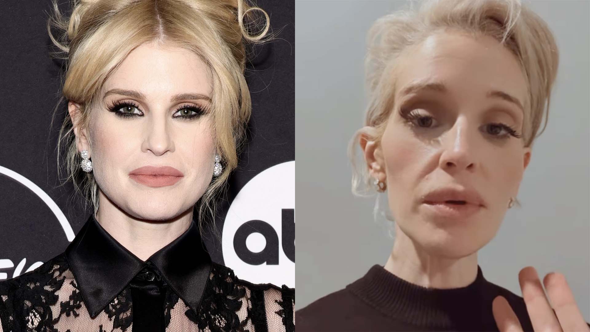 Antes e depois de Kelly Osbourne - Foto: Reprodução / Instagram