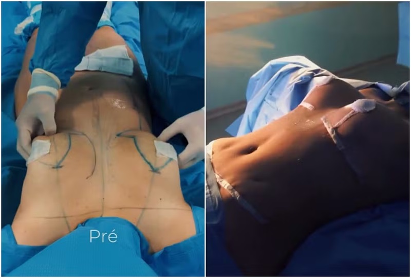 Antes e depois de Camila Moura — Foto: Reprodução/Instagram