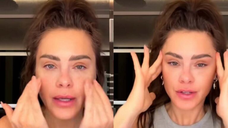 Carolina Dieckmmann surge inchada e revela o que fez no rosto: ‘Simples assim’