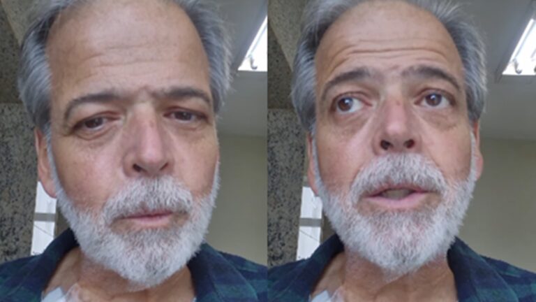 Internado, ator Claudio Cinti revela seu estado de saúde dez dias após transplante