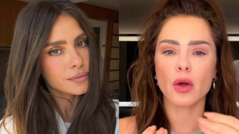 Dermatologista de Carolina Dieckmmann revela o que é feito no rosto da atriz