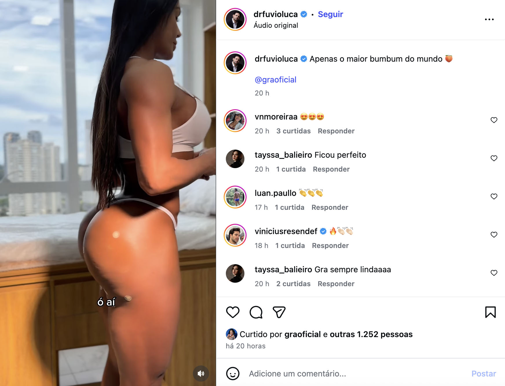 Gracyanne Barbosa faz harmonização nos glúteos - Foto: Reprodução / Instagram