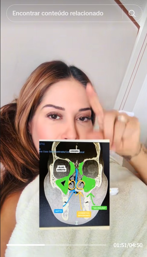 Maíra Cardi mostra exame - Foto: Reprodução/TikTok @cardinigro
