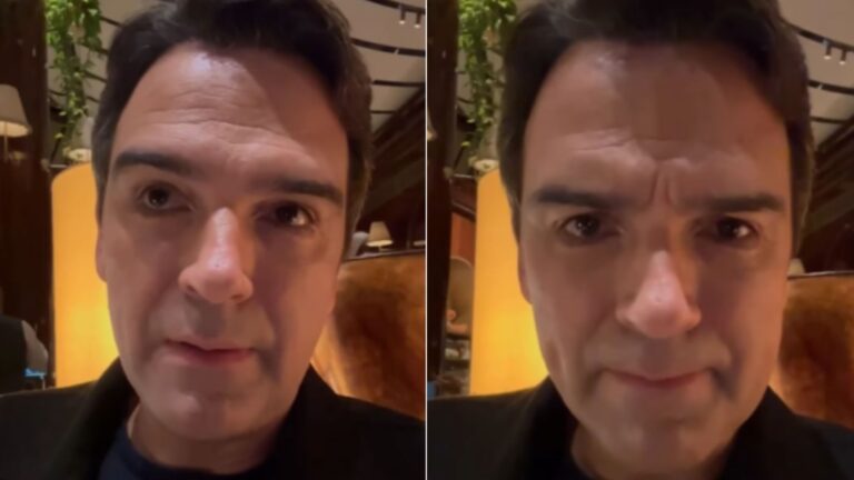 Tadeu Schmidt fala sobre implante de cabelo: ‘Isso é particular’