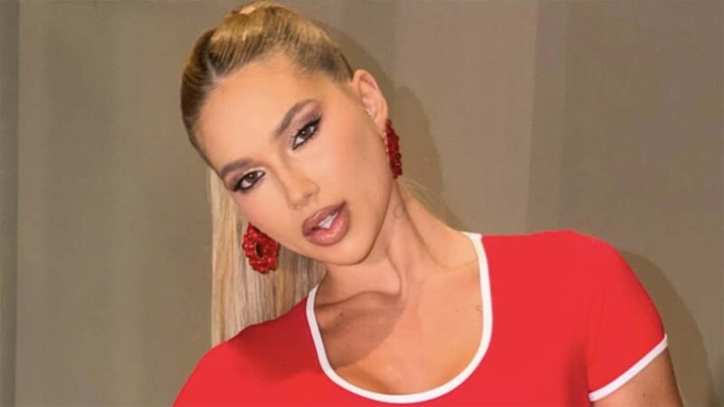 Virginia exibe sequela do estresse em sua pele após eventos