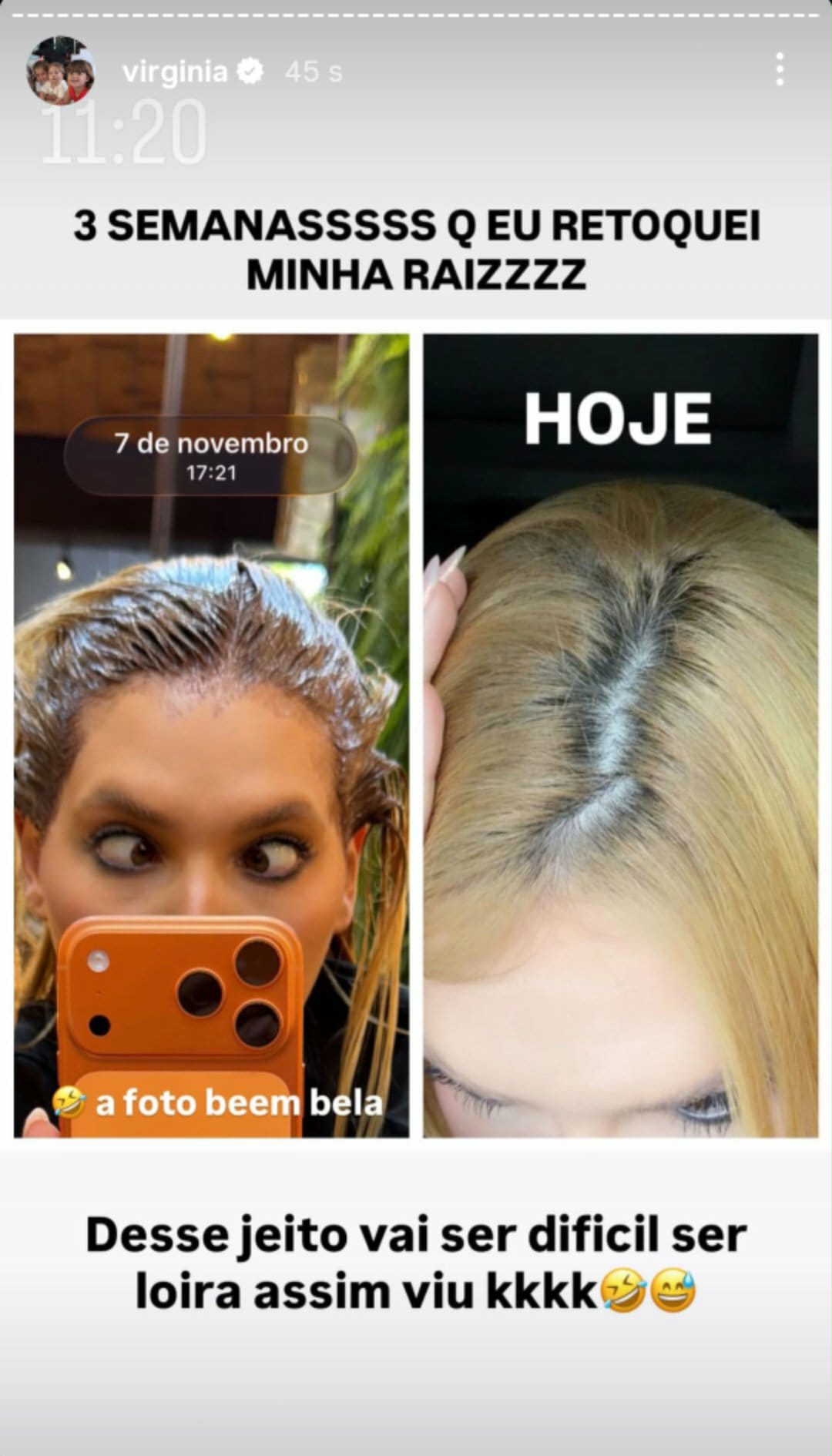 Virginia enfrenta perrengue com o cabelo