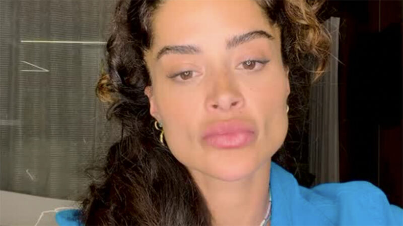 Transformação do rosto de Aline Campos, do BBB 26: o começo da fama e agora