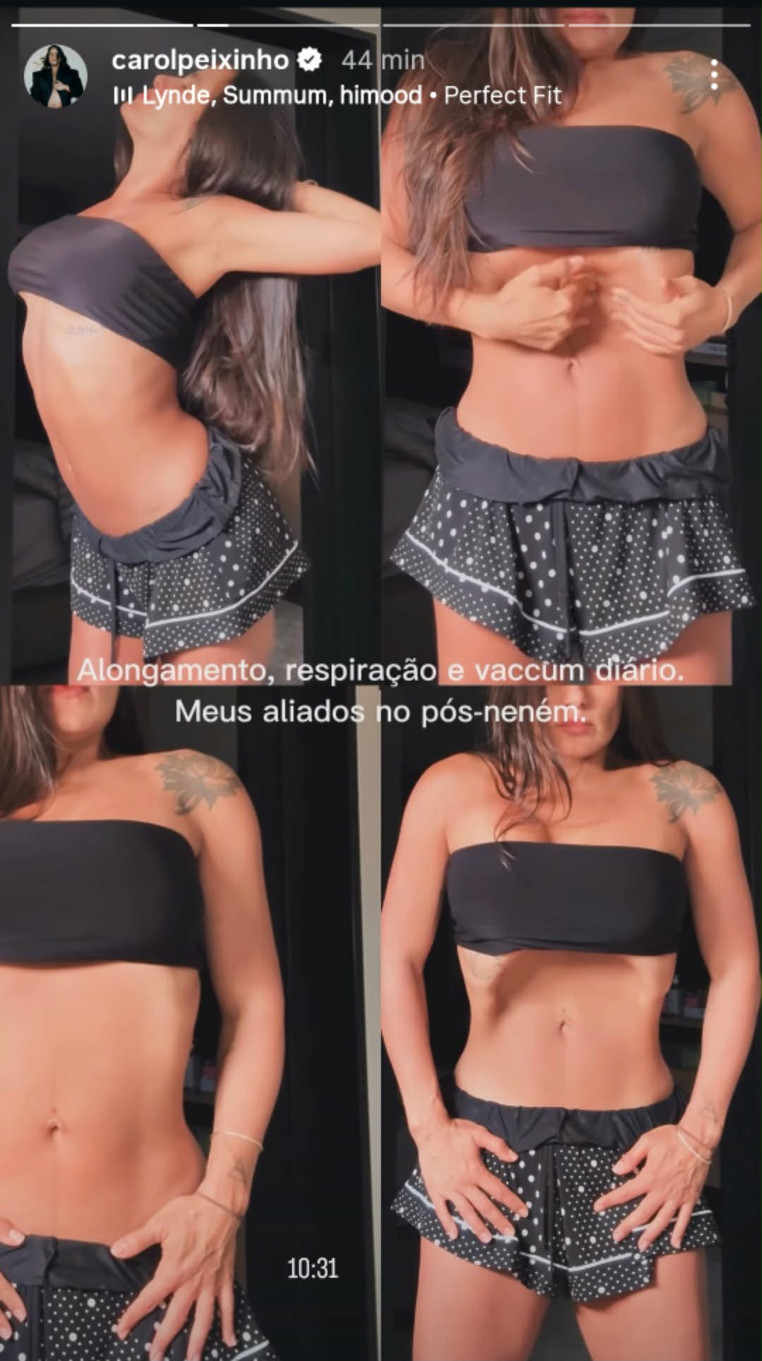 Carol Peixinho mostra técnicas que usa para sua barriga voltar após a gestação
