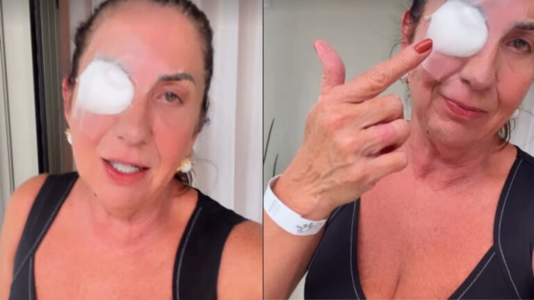 Margareth Serrão faz cirurgia no olho esquerdo