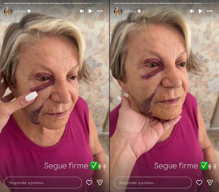 Eponina Rocha – Foto: Reprodução / Instagram