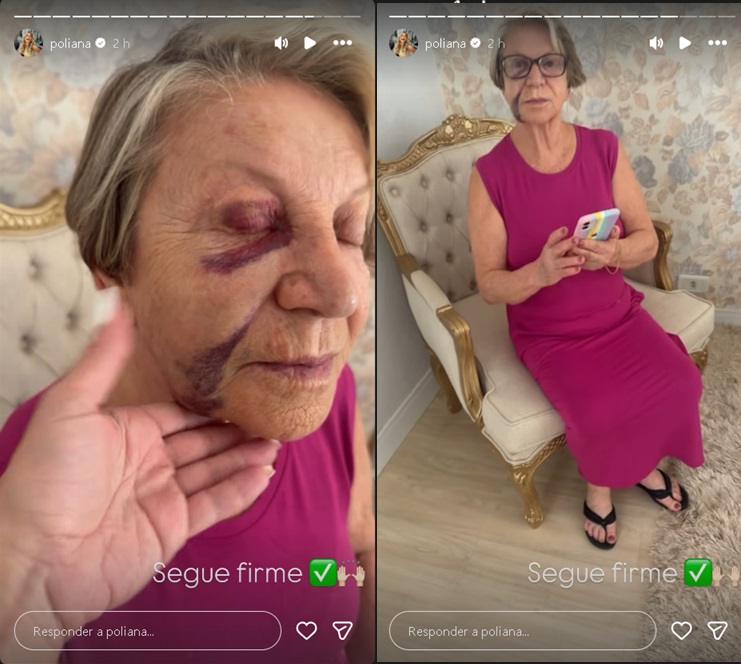 Eponina Rocha – Foto: Reprodução / Instagram