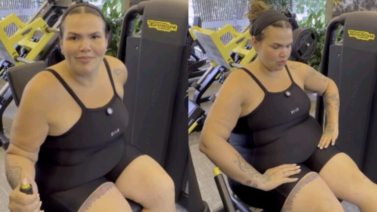 Thais Carla fala sobre nova cirurgia após perder 81 kg: ‘Não adianta…’