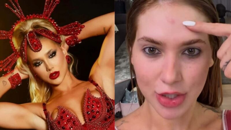Virginia mostra machucado após ensaio de rua com a Grande Rio