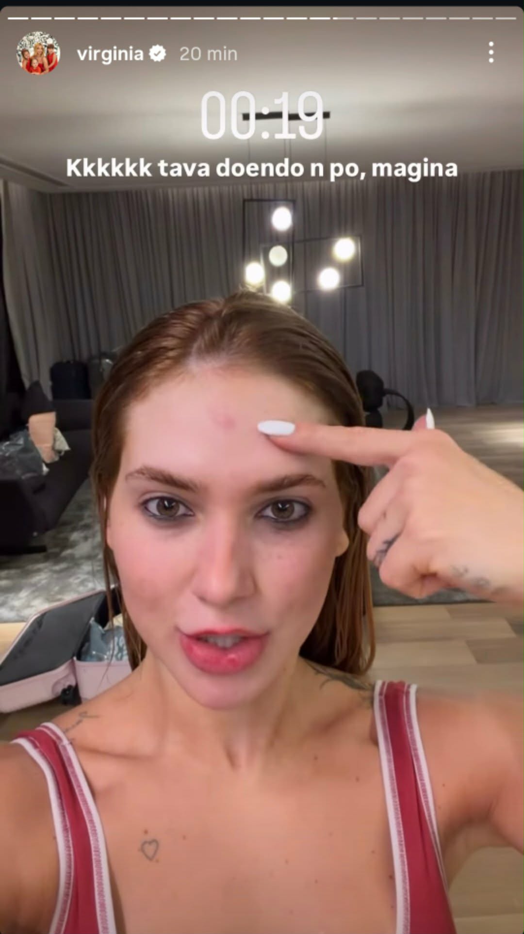 Virginia mostra machucado após ensaio de rua com a Grande Rio