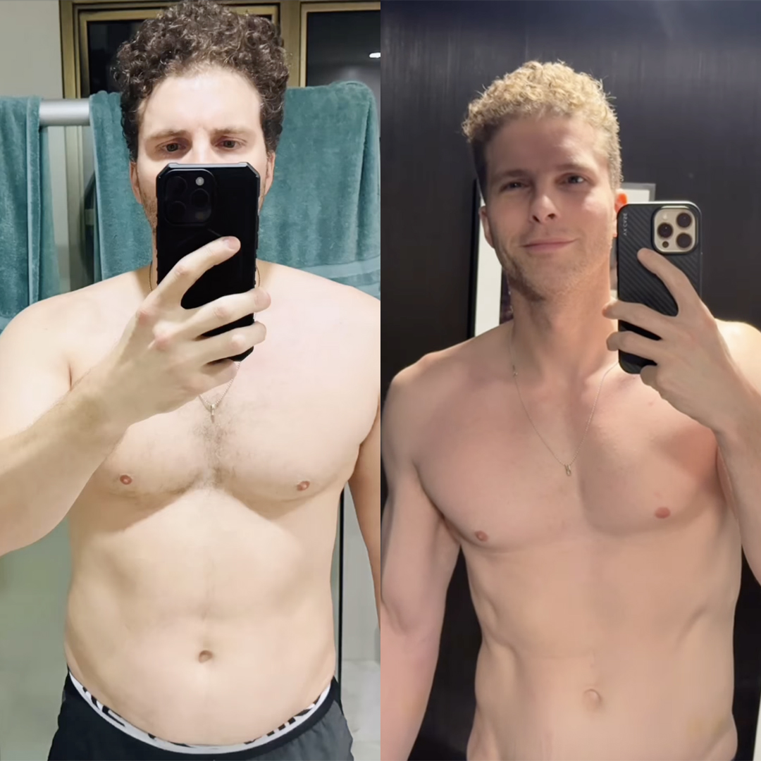Antes e depois de Thiago Fragoso - Foto: Reprodução / Instagram