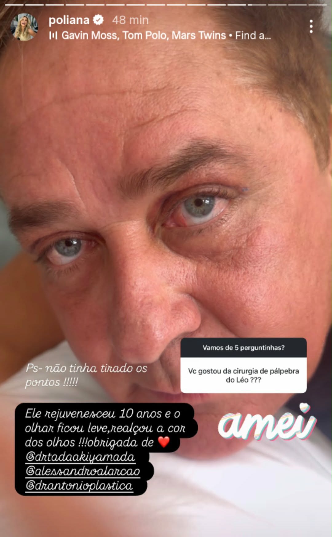 Poliana Rocha fala sobre pálpebra de Leonardo