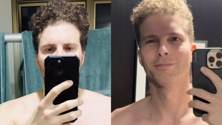 Aos 44 anos, Thiago Fragoso foca na saúde e emagrece muito em 1 ano. Veja antes e depois