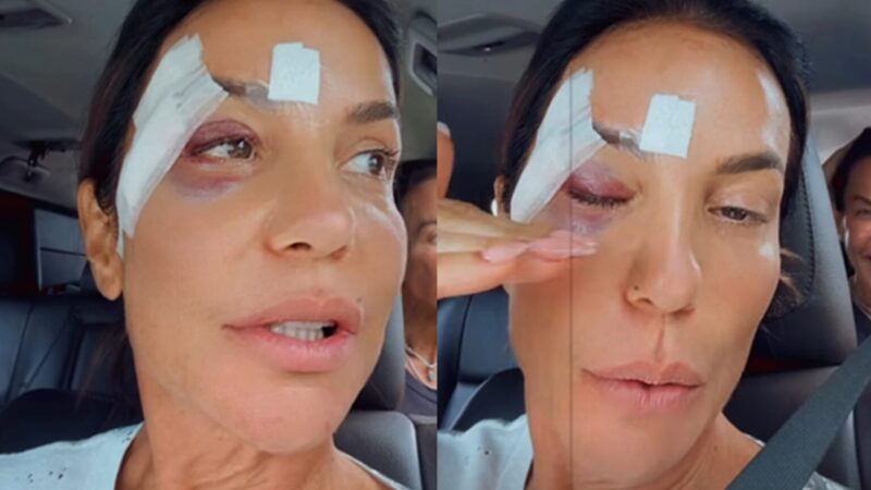 'Pode atingir qualquer pessoa': o que está por trás de desmaio sofrido por Ivete Sangalo?