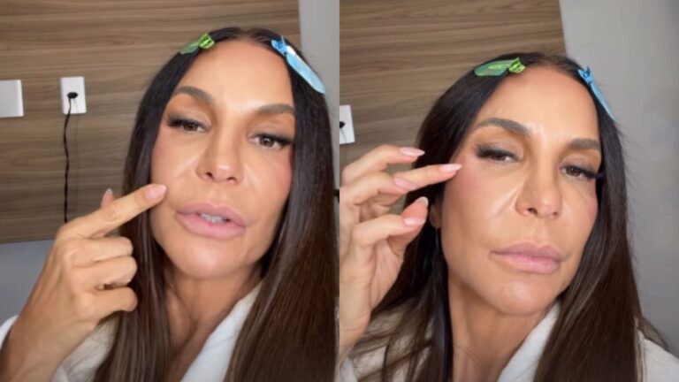 Ivete Sangalo fala sobre recuperação e atualiza estado de saúde