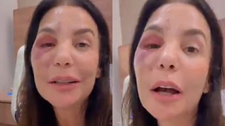 Ivete Sangalo recebe alta após ficar internada para passar por cirurgia