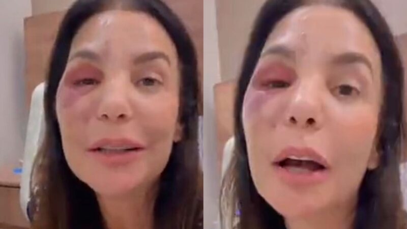 Ivete Sangalo recebe alta após ficar internada para passar por cirurgia