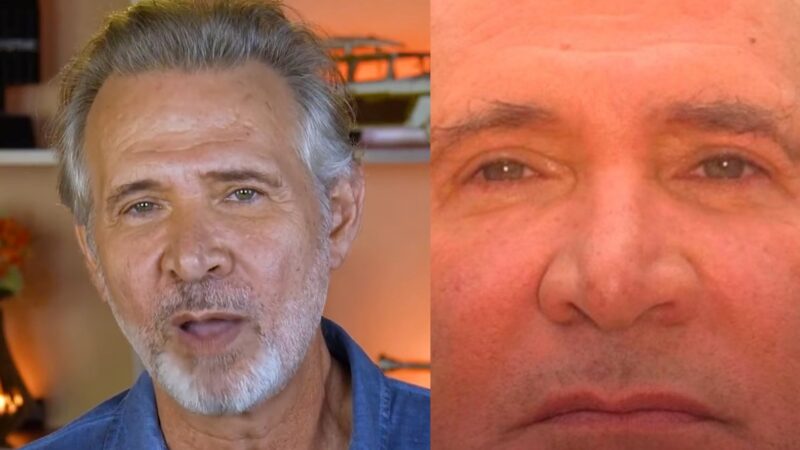 Aos 63 anos, Nelson Freitas faz harmonização facial; veja o antes e depois