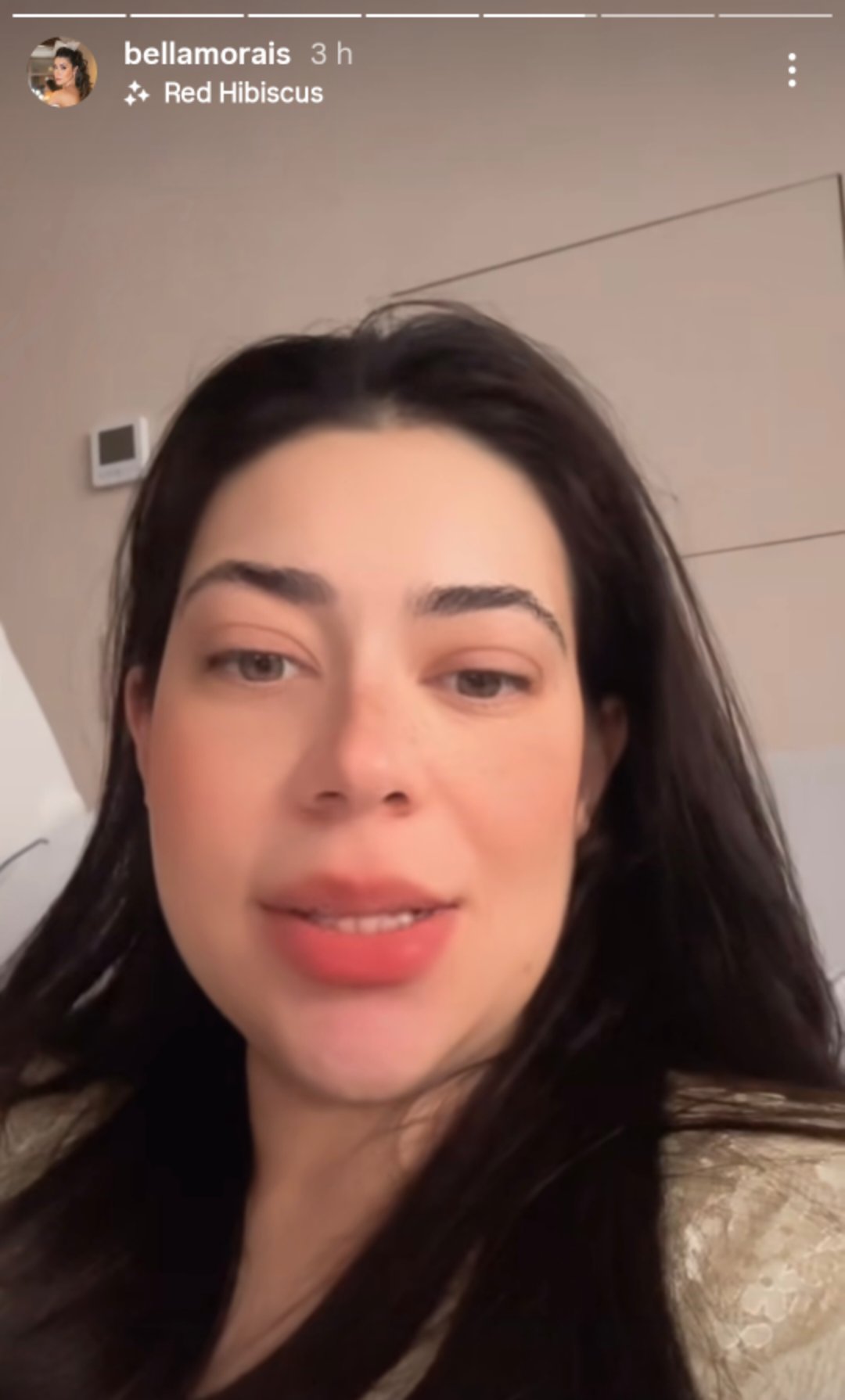 Nora de Sonia Abrão explica seu segundo parto prematuro