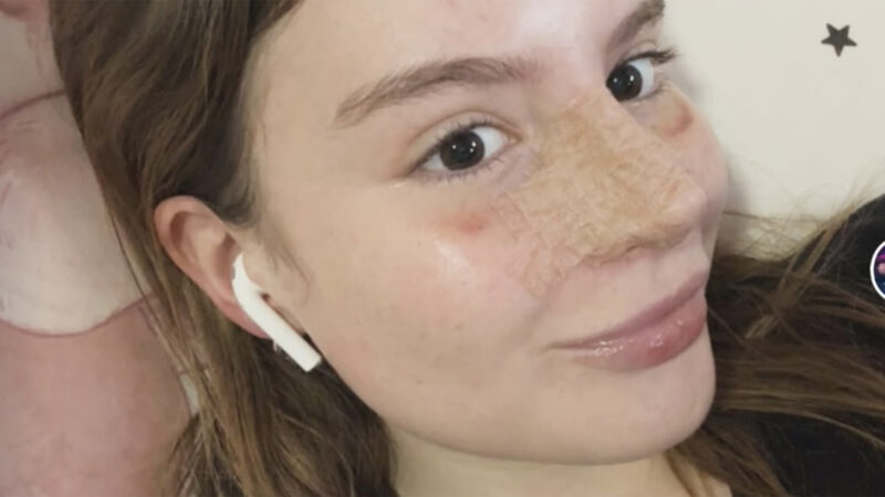 Aos 20 anos, Sophia Valverde exibe o resultado de cirurgia plástica no nariz