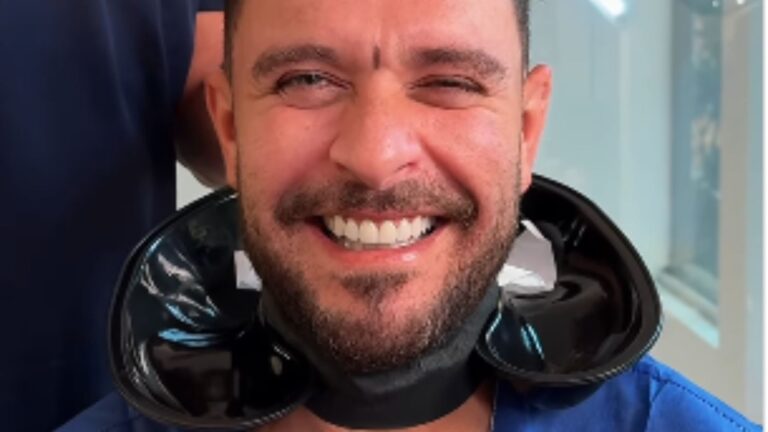 Transplante capilar? Aos 44 anos, Diogo Nogueira é alvo de rumores de novo procedimento