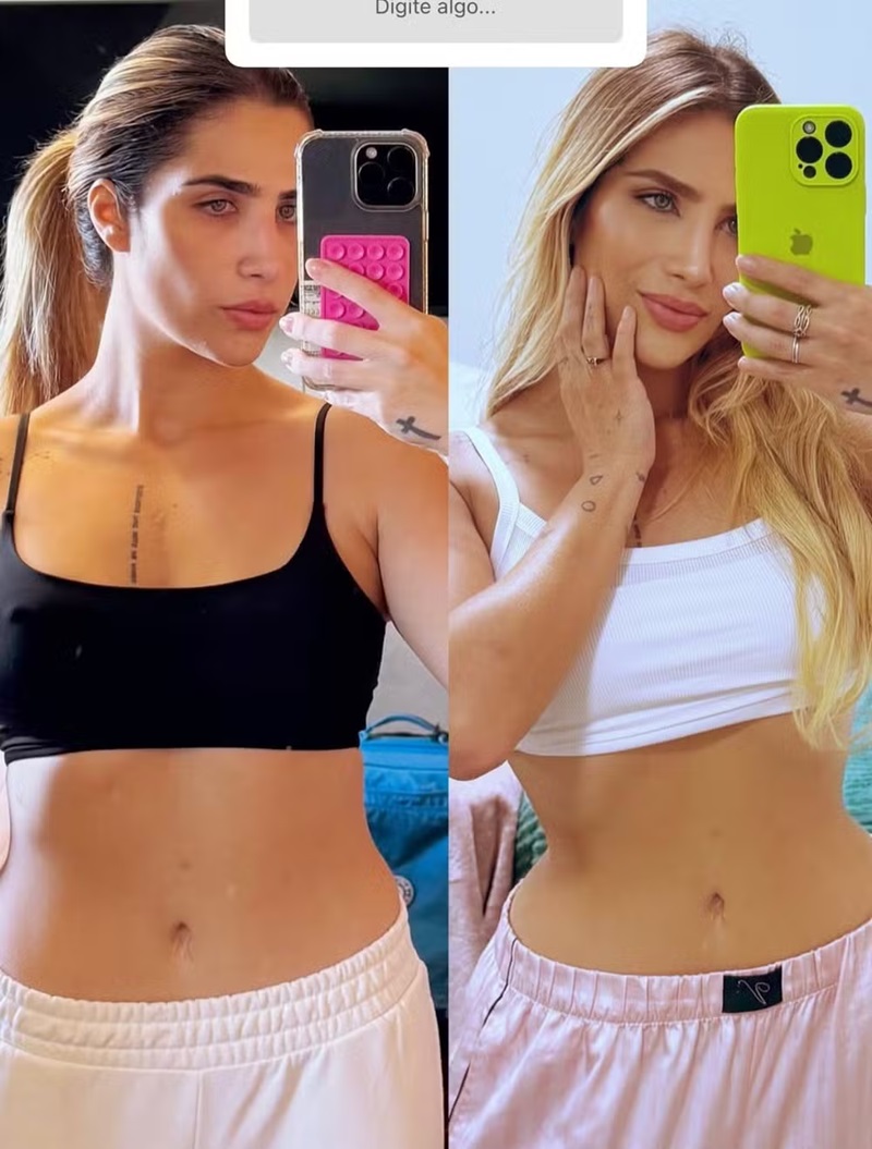 Antes e depois de Jéssica Beatriz Costa — Foto: Reprodução/Instagram