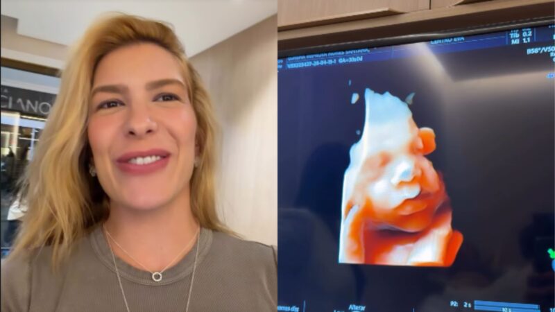Grávida, Lore Improta exibe ultrassom do filho e admite: ‘A cara do papai’