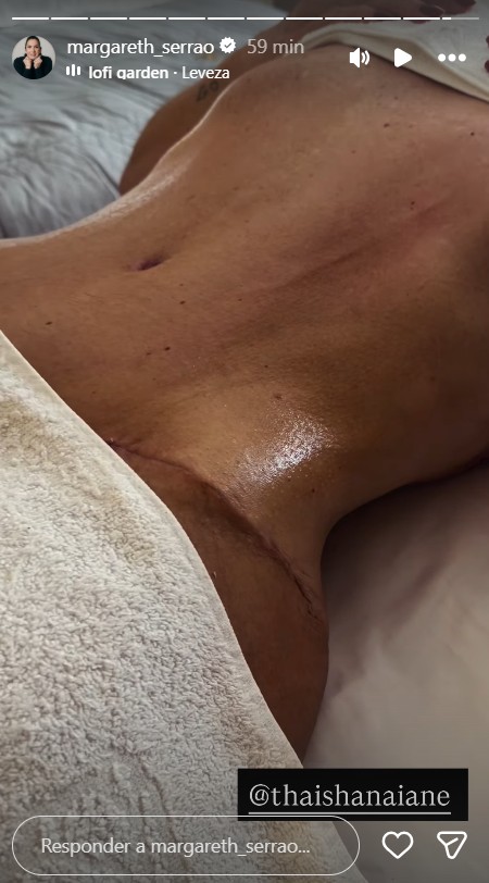 Margareth Serrão exibe resultado da abdominoplastia - Foto: Reprodução / Instagram @margareth_serrao 