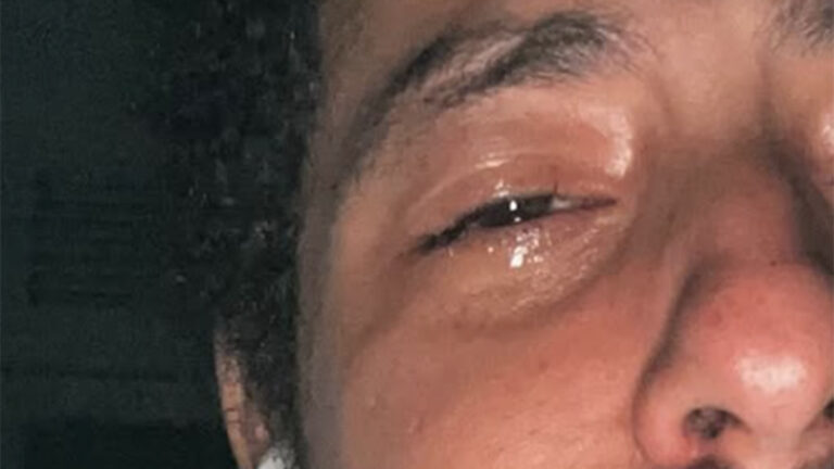 Ex-Malhação, ator de 31 anos chora em desabafo sobre depressão