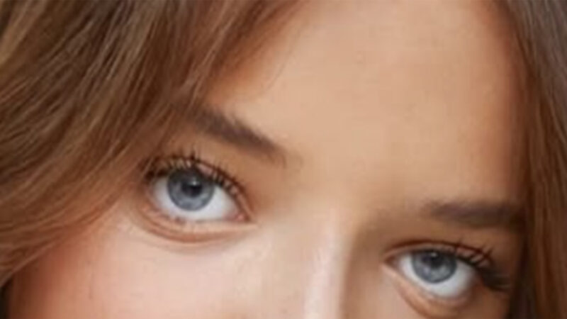 Aos 16 anos, Rafaella Justus faz a segunda rinoplastia de sua vida e mostra o resultado