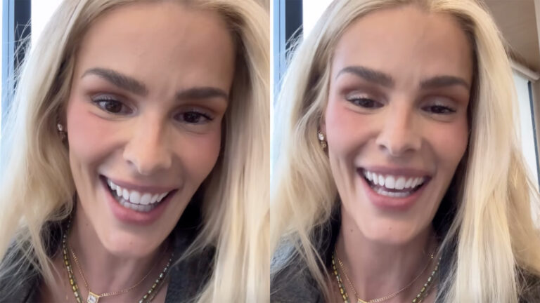 Menos 25 kg: Yasmin Brunet choca ao mostrar antes e depois