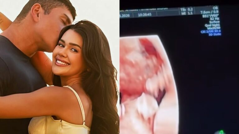 Franciny Ehlke mostra rostinho da filha em ultrassom e encanta os fãs: “Esse nariz é seu”