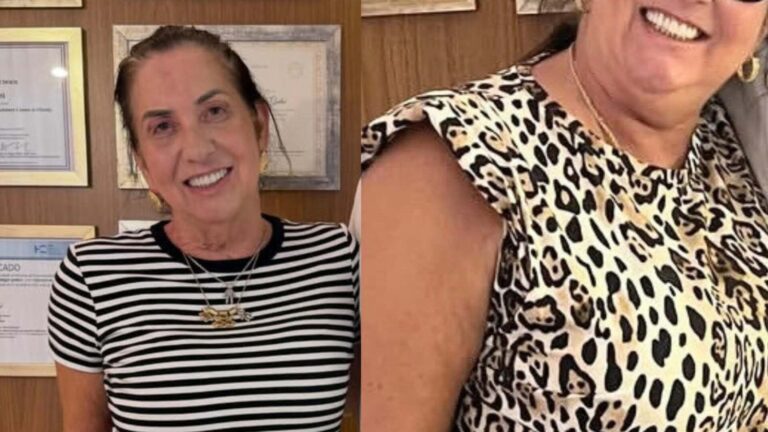 Aos 60 anos, mãe de Virginia tem transformação impressionante; veja o antes e depois