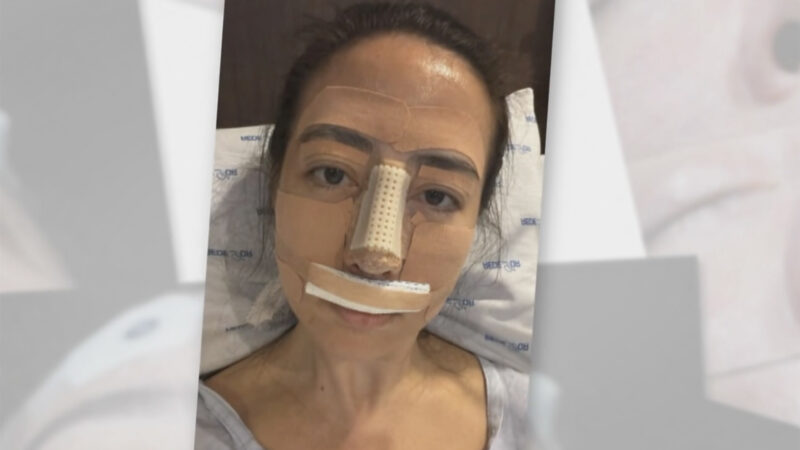 Repórter da Globo sofre complicação em cirurgia: ‘Risco alto de necrose’