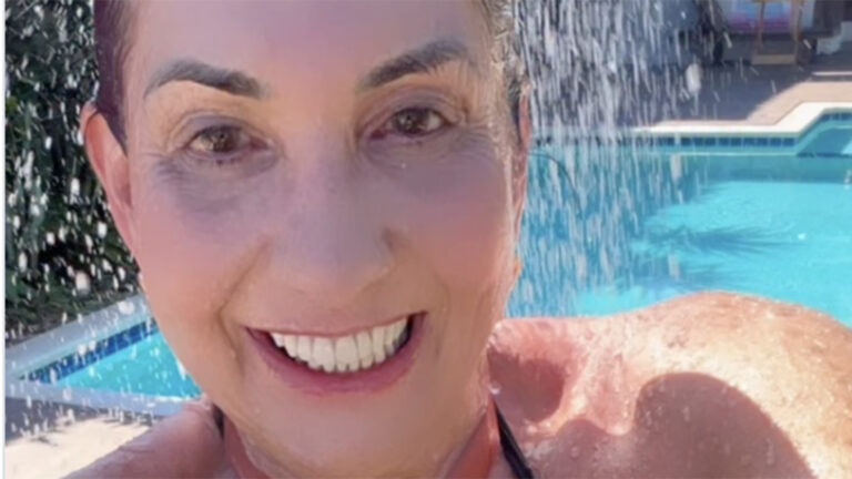 Aos 60 anos, mãe de Virginia exibe o resultado da cirurgia plástica em fotos de biquíni