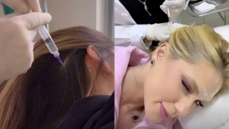 Virginia Fonseca faz aplicação de botox na cabeça; entenda o procedimento