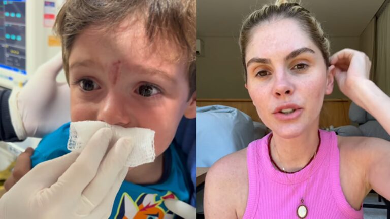 Bárbara Evans relata susto com acidente doméstico do filho de 2 anos: ‘Abriu’